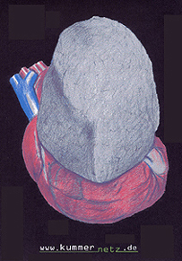 kummernetzplakatstein